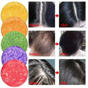 DBEAUTYM 8 Pack Shampoo Bar Gift Set,Natural Soap, Solid Dry Damaged Hair With Plant Essence Oil Helps Stop Loss and Promotes Healthy Growth, Travel Size Bulk Set