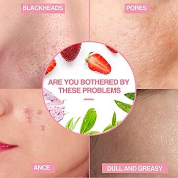Strawberry Clay Mask, Exfoliating Strawberry Clay Facial Mask with Volcanic Mud & White Tea for Cleansing, Healing & Hydrating Strawberry Facial Mask Skin Care Mask for Radiant Skin Acne And Dull
