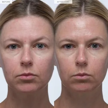 Glow Recipe Hyaluronic Acid Serum for Radiant Skin