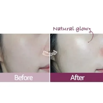 EasyDew EGF Eye Stick Balm for Fine Lines and Wrinkles