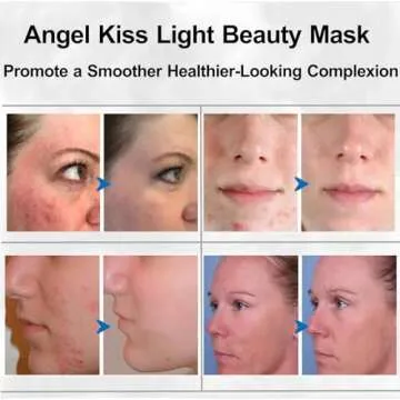 Angel Kiss Light Beauty Mask - Led Face Mask Light Therapy - Red Light Therapy Mask for Face - LED Facial Skin Care Mask