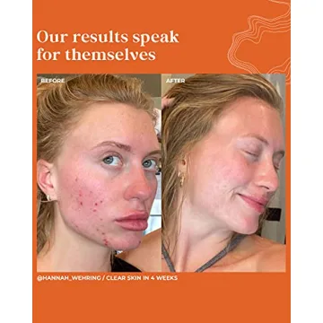 Terasana Clear Skin Face Serum - Vegan & Cruelty-Free