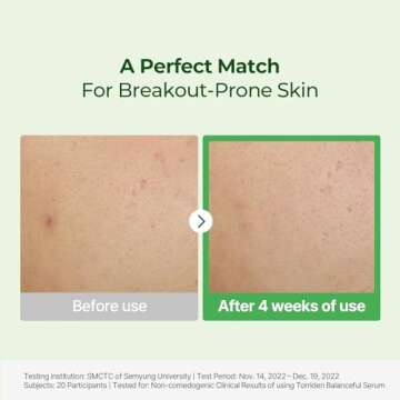 Torriden BALANCEFUL Serum 50ml (1.69 fl.oz.) | Instant Soothing and Balancing Care for Sensitive Skin | 5D CICA, Hydrolyzed Hyaluronic Acid, Panthenol | Korean Facial Serum