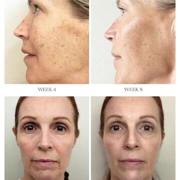 City Beauty Advanced Retinol System - 2 Anti-Aging Face Serums - Retinol & Vitamin C - Firm, Smooth ...