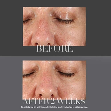 Kate Somerville Resurfacing Overnight Peel Powerful Anti-Aging Treatment