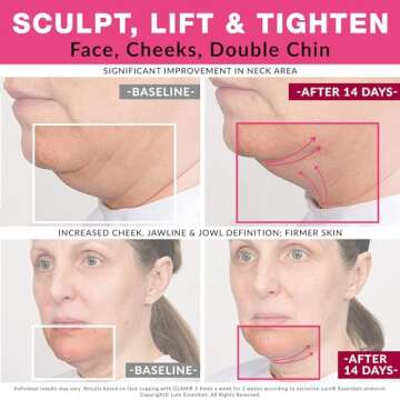 Glam Facial Face Cupping Set - Cupping Therapy Sets Massage Kit with Silicone Cleansing Brush for Instantly Ageless Skin, Works for Fine Lines & Wrinkles, Improves Collagen (Glam - Pink)