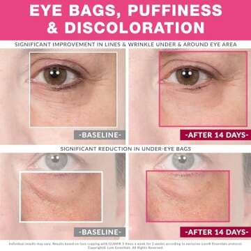 Glam Facial Face Cupping Set - Cupping Therapy Sets Massage Kit with Silicone Cleansing Brush for Instantly Ageless Skin, Works for Fine Lines & Wrinkles, Improves Collagen (Glam - Pink)