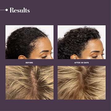 Inala Power Potion Hair Growth Serum for All Hair Types