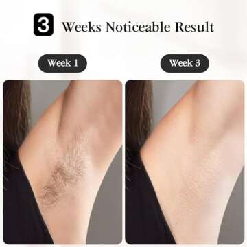 Effective JOVS IPL Hair Removal Device with 24J Technology