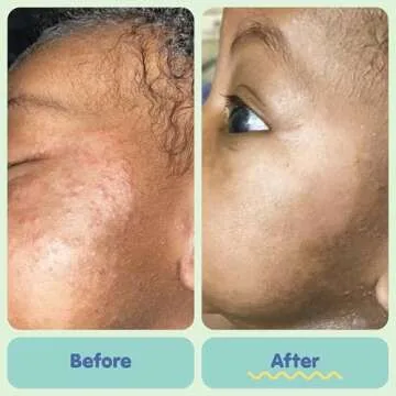 TUBBY TODD Baby Bath & Skincare Kit - Perfect for Baby Care