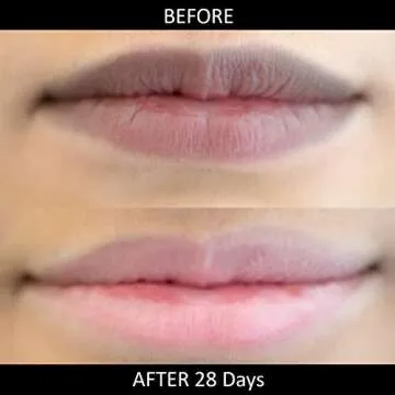 Omorfee 100% Organic Lip Lightening Balm, balm for Dark Lips, Balm with SPF, Natural Protection, Repair, Moisturizer, Cocoa Butter, Carrot Seed Oil & Pineapple Extract -10g/ 0.35Oz