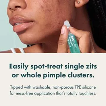 Hero Cosmetics Pimple Correct Acne Clearing Gel Pen - Maximum Strength 2% Salicylic Acid, Non-Drying Formula for Early Stage and Emerging Pimples (1 Count)