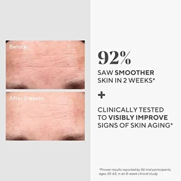 Murad Retinol Youth Renewal Serum for Youthful Skin