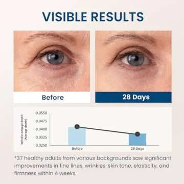 5% Caffeine 5% Retinol Eye Cream for Dark Circles, Puffiness and Bags, Hyaluronic Acid and Niacinamide Under Eye Cream Anti Aging, Eye Serum for Fine Lines, 360° Eye Massage Ball Roller