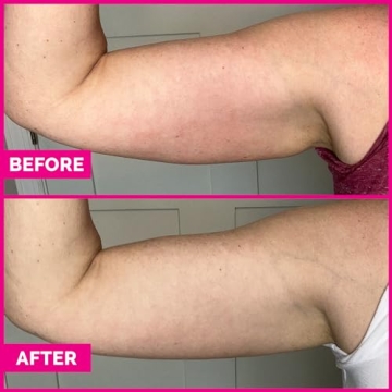 Arm Sleek Firming Cream for Beautiful Arms Every Age