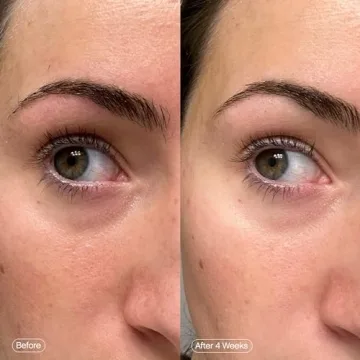 Topicals Faded Brightening Under Eye Masks for Dark Circles