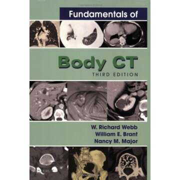 Fundamentals of Body CT - 3rd Edition by Webb, Brant, and Major