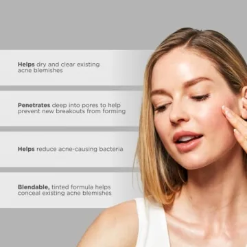 Glytone Acne Spot Treatment Cream with 8% Sulfur and Tinted Concealer