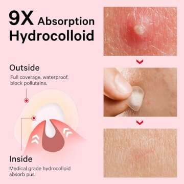 Sosky Pimple Patches for Face, FSA HSA Eligible Invisible Hydrocolloid Acne Patches, Zit Sticker for Face and Skin, Pimple Patches for Covering Zits, Blemishes with Salicylic Acid 48 Count