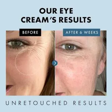 Affordable Under Eye Cream for Dark Circles and Puffiness