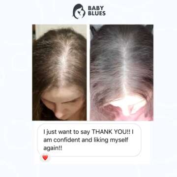 Baby Blues Vitamins for Postpartum Hair Loss - Biotin & Collagen