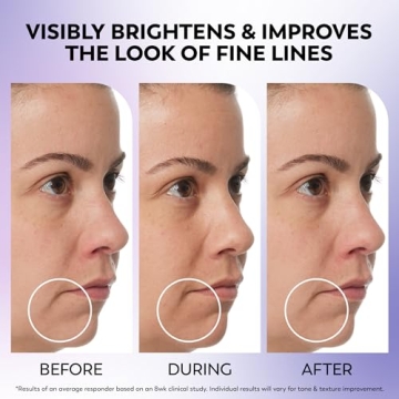 Olay Retinol 24 Face Moisturizer for Youthful Skin