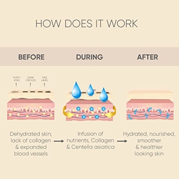 Under Eye Patches (20 Pairs) - Eye Patches For Puffy Eyes And Dark Circles - Under Eye Mask For Beauty & Personal Care - Under Eye Mask Amino Acid & Collagen For Dark Circles And Puffiness by Celor