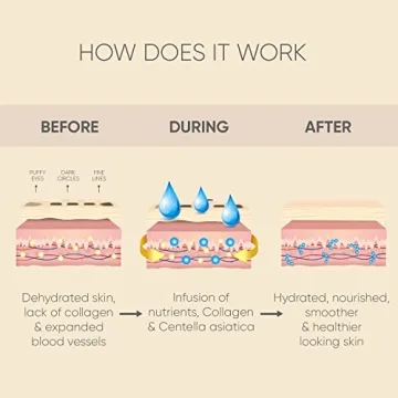 Under Eye Patches (20 Pairs) - Eye Patches For Puffy Eyes And Dark Circles - Under Eye Mask For Beauty & Personal Care - Under Eye Mask Amino Acid & Collagen For Dark Circles And Puffiness by Celor