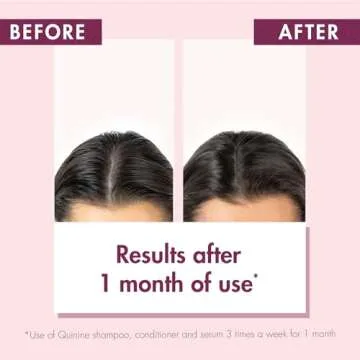 Klorane - Strengthening Shampoo - with Quinine & Edelweiss For Thinning Hair - Support Thicker Hair - Silicone, Paraben & Sulfate Free - 13.5 fl. oz.