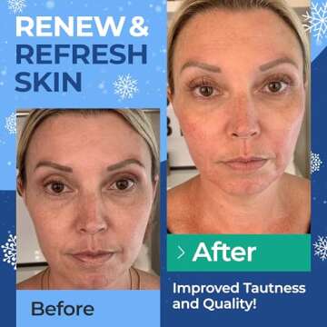 InstaSkincare Collagen Peptides Powder for Women Hydrolyzed Collagen Supplements Types I - III Non-GMO Grass-Fed Gluten-Free Kosher Pareve Unflavored Easy to Mix Healhty Hair Skin Joints 10.58 Oz