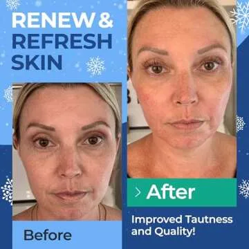 InstaSkincare Collagen Peptides Powder for Women Hydrolyzed Collagen Supplements Types I - III Non-GMO Grass-Fed Gluten-Free Kosher Pareve Unflavored Easy to Mix Healhty Hair Skin Joints 10.58 Oz