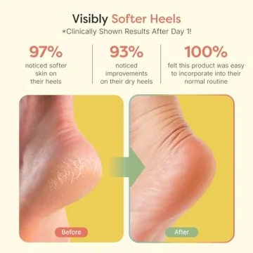 ZenToes Moisturizing Sleep Socks for Cracked Heels