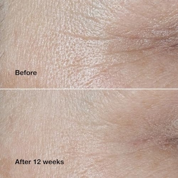 Clinique Smart Clinical Repair Anti-Aging Face Cream 1.7 Fl Oz