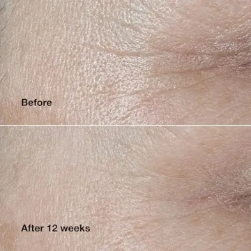 Clinique Smart Clinical Repair Anti-Aging Face Cream 1.7 Fl Oz