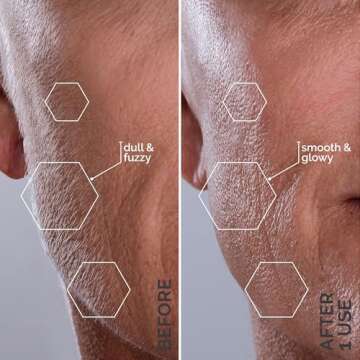 Michael Todd Beauty - Sonicsmooth – SONIC Technology Dermaplaning Tool - 2 in 1 Women’s Facial Exfoliation & Peach Fuzz Hair Removal System with 8 Weeks of Dermaplaning Blades