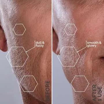 Michael Todd Beauty - Sonicsmooth – SONIC Technology Dermaplaning Tool - 2 in 1 Women’s Facial Exfoliation & Peach Fuzz Hair Removal System with 8 Weeks of Dermaplaning Blades