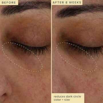 Farmacy Brightening Eye Cream - Wake Up Honey Under Eye Cream for Dark Circles + Puffiness - Caffeine Eye Cream Enriched with Vitamin C + Cranberry Peptide to Smooth Wrinkles Over Time (6ml)