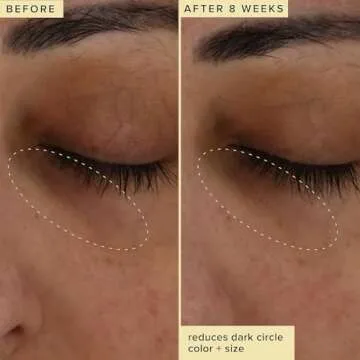 Farmacy Brightening Eye Cream - Wake Up Honey Under Eye Cream for Dark Circles + Puffiness - Caffeine Eye Cream Enriched with Vitamin C + Cranberry Peptide to Smooth Wrinkles Over Time (6ml)