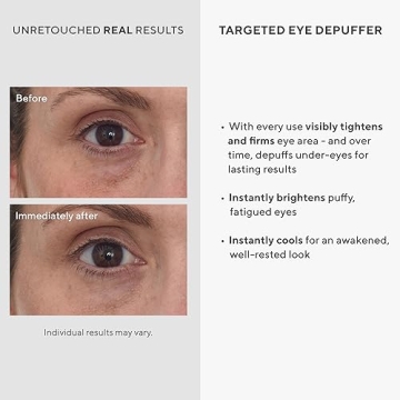 Murad Eye Cream to Brighten, Depuff, and Firm Under-Eyes