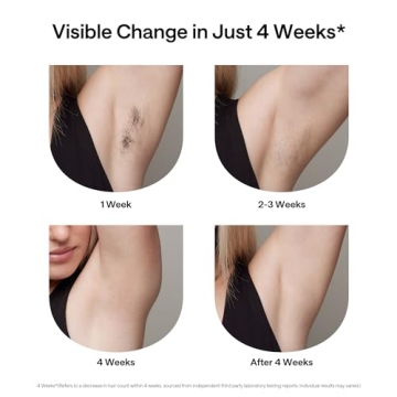 Ulike Laser Hair Removal: Safe, Effective, and Painless