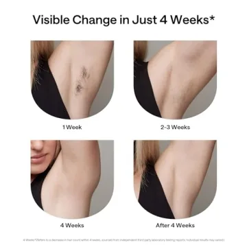 Ulike Laser Hair Removal: Safe, Effective, and Painless