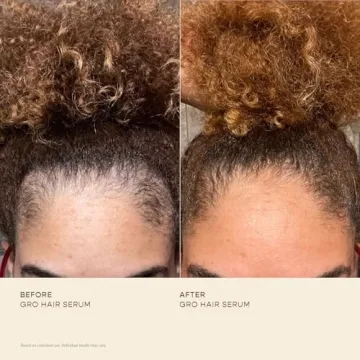 VEGAMOUR GRO Hair Serum for Thicker Fuller Hair Vegan