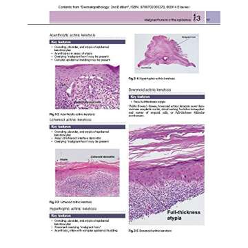 Dermatopathology: Expert Consult - Online and Print