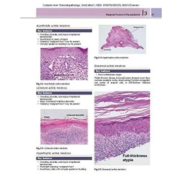 Dermatopathology: Expert Consult - Online and Print