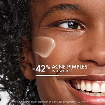 Vichy Normaderm Acne Control Daily Moisturizer, Acne Moisturizer For Face, 2% Salicylic Acid + Hyalu...