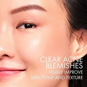 Vichy Normaderm Acne Control Daily Moisturizer, Acne Moisturizer For Face, 2% Salicylic Acid + Hyaluronic Acid + Vitamin C, Acne Treatment For Blackheads, Acne Blemishes & Enlarged Pores, Oil Free