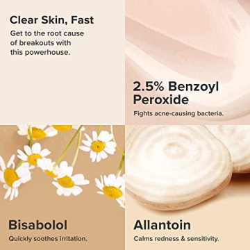 Paula's Choice Acne Treatment with Benzoyl Peroxide, 2.25 Fl. Oz.