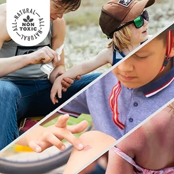 Active Skin Repair Hydrogel for Burn Relief - Natural & Safe