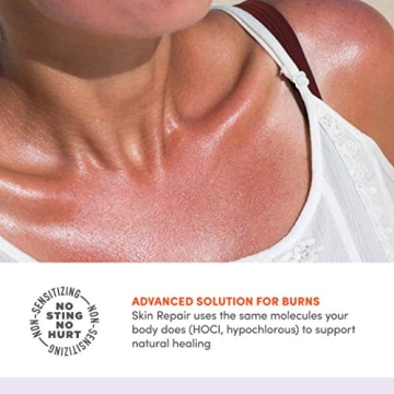 Active Skin Repair Hydrogel for Burn Relief - Natural & Safe