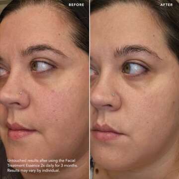 SK-II Facial Treatment Essence - Anti-Aging Essence Skincare to Help Reduce The Appearance of Fine L...